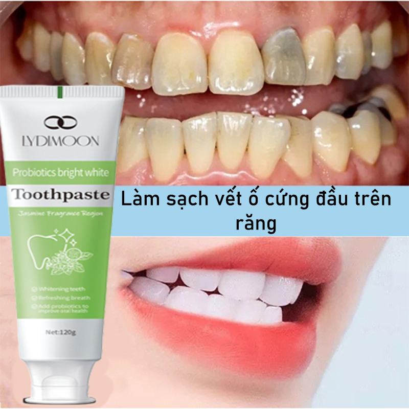 Làm trắng răng tẩy trắng răng Kem đánh răng 120g Làm trắng răng Loại bỏ cao răng chăm sóc nướu làm hơi thở thơm mát