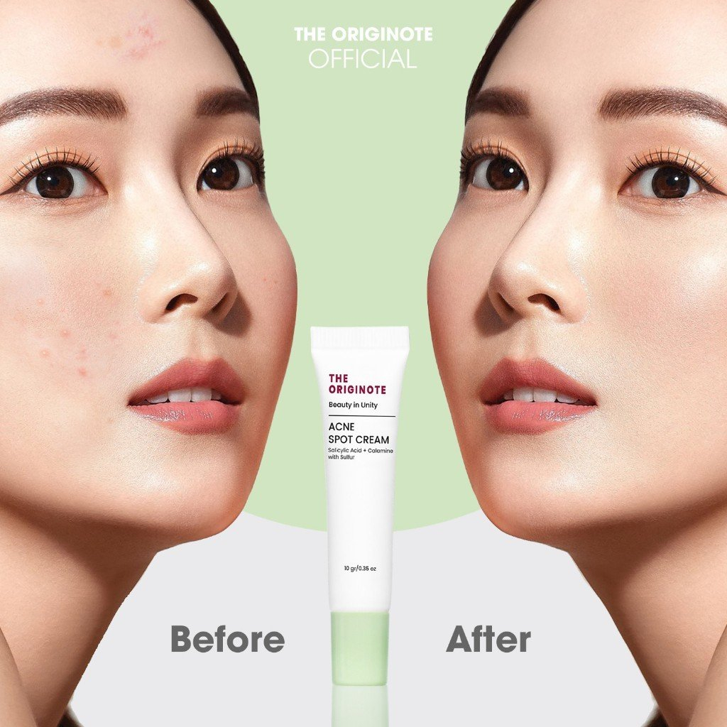 Kem chấm mụn The Originote Acne Spot Cream 10gr 7619
