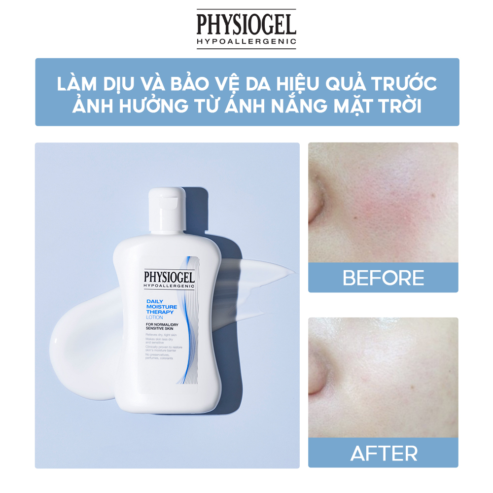 Sữa Dưỡng Ẩm Ngăn Ngừa Mất Nước Physiogel Daily Moisture Therapy Lotion 100ml & 200ml