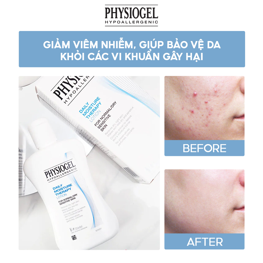 Sữa Dưỡng Ẩm Ngăn Ngừa Mất Nước Physiogel Daily Moisture Therapy Lotion 100ml & 200ml