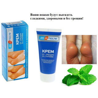 Kem bôi Nứt Gót Chân KPEM"Trước và sau"của Nga Dưỡng Ẩm và làm mềm chân  siêu hiệu quả/50ml