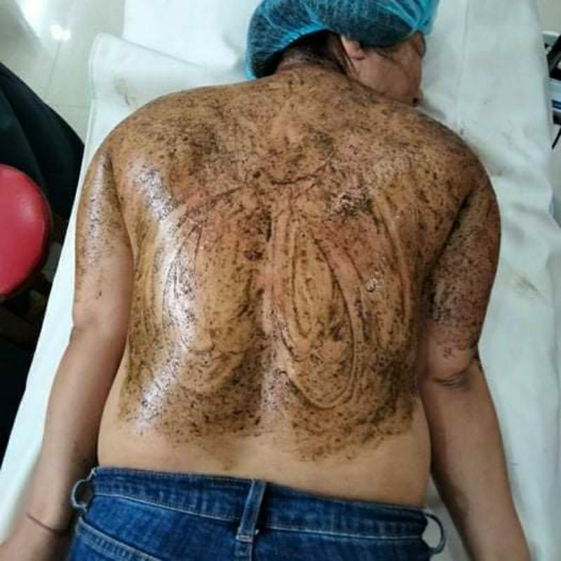 Vi tảo trẻ hóa da,sạch mụn,thâm, nám, tái tạo da tại nhà bong nhanh,mạnh