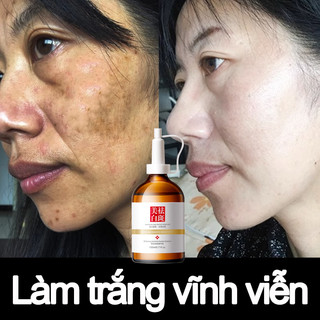 Kem nám tàn nhang serum trắng da mặt 100ml Dưỡng trắng mịn da ,Hiệu quả làm mờ thâm nám tàn nhan,kem thâm nám