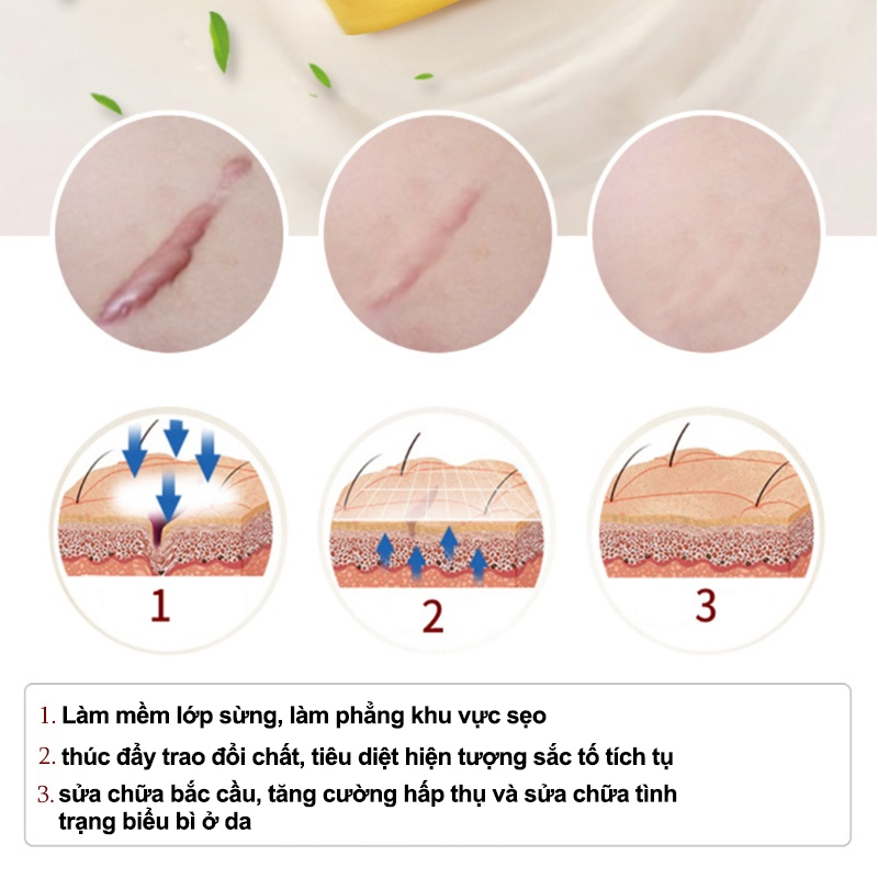 Kem Sẹo Kem xóa Sẹo dermatix Sửa chữa sẹo Kem tẩy tế sẹo Sẹo tăng sinh Vết sẹo phẫu thuật Chuyên