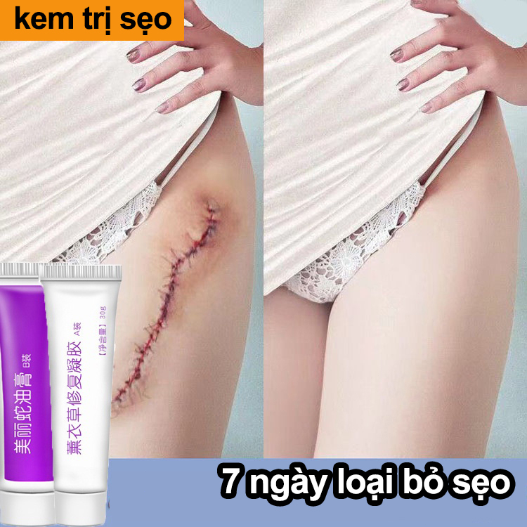 Kem Sẹo Kem xóa Sẹo dermatix Sửa chữa sẹo Kem tẩy tế sẹo Sẹo tăng sinh Vết sẹo phẫu thuật Chuyên