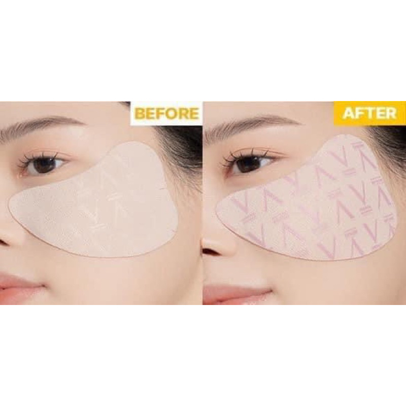 Dán Chống Nắng Giảm Thâm Sạm Medianswer 1 Cặp
