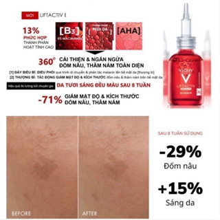 Tinh Chất Vichy Làm Mờ Vết Thâm Và Nếp Nhăn 30ml LiftActiv B3 Serum Dark Spots & Wrinkles