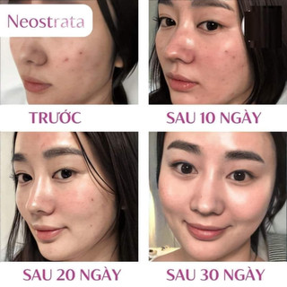 Neostrata Oily Skin Solution Lotion AHA 8% (chất lỏng)