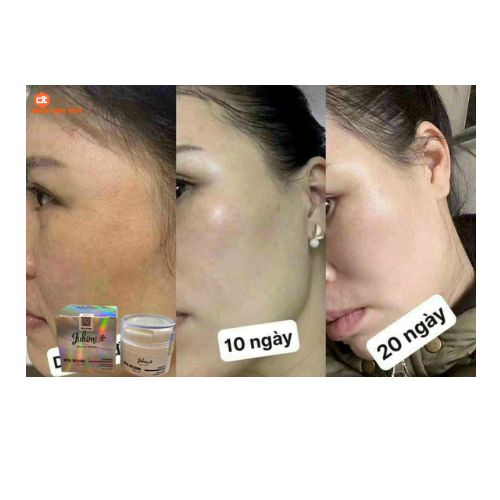 Kem Dưỡng Ức Chế Nám Jukimi Organic Beauty Royal Melasma Nhật Bản 25g