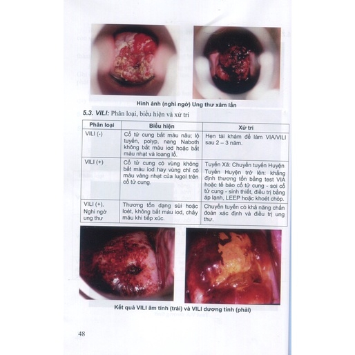 Sách - Thủ Thuật Sản Phụ Khoa