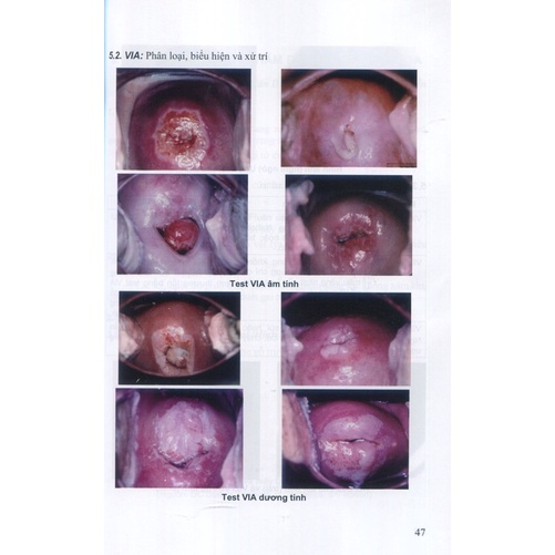 Sách - Thủ Thuật Sản Phụ Khoa