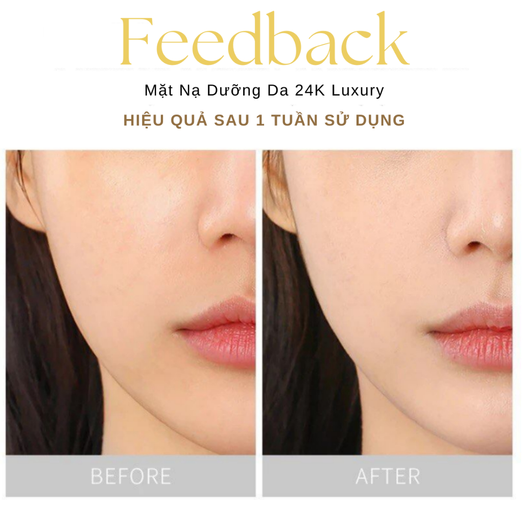 Mặt Nạ Vàng 24K Luxury Silk Mask Nội Địa Tung Dưỡng Ẩm Trắng Sáng Da Giảm Mụn Thâm Tái Tạo Collagen Nâng Cơ Da Mặt 25ml