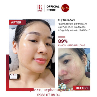 SERUM MỤN HAKI 🇰🇷