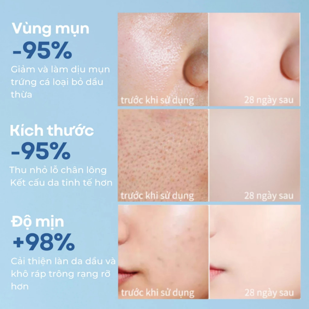 Nước Tẩy Trang Compliment Sạch Sâu Dịu Nhẹ Phù Hợp Mọi Loại Da Micellar Water 400ml