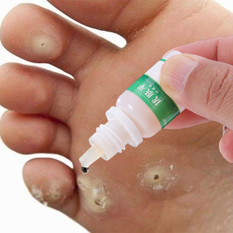 CHÍNH HÃNG Gel Tẩy Nốt Ruồi Mụn Cơm Mụn Cóc Mụn Thịt Tẩy Nốt Ruồi Mắt Cá Kem tẩy xoá nốt ruồi hiệu quả sau 3 - 5 ngày