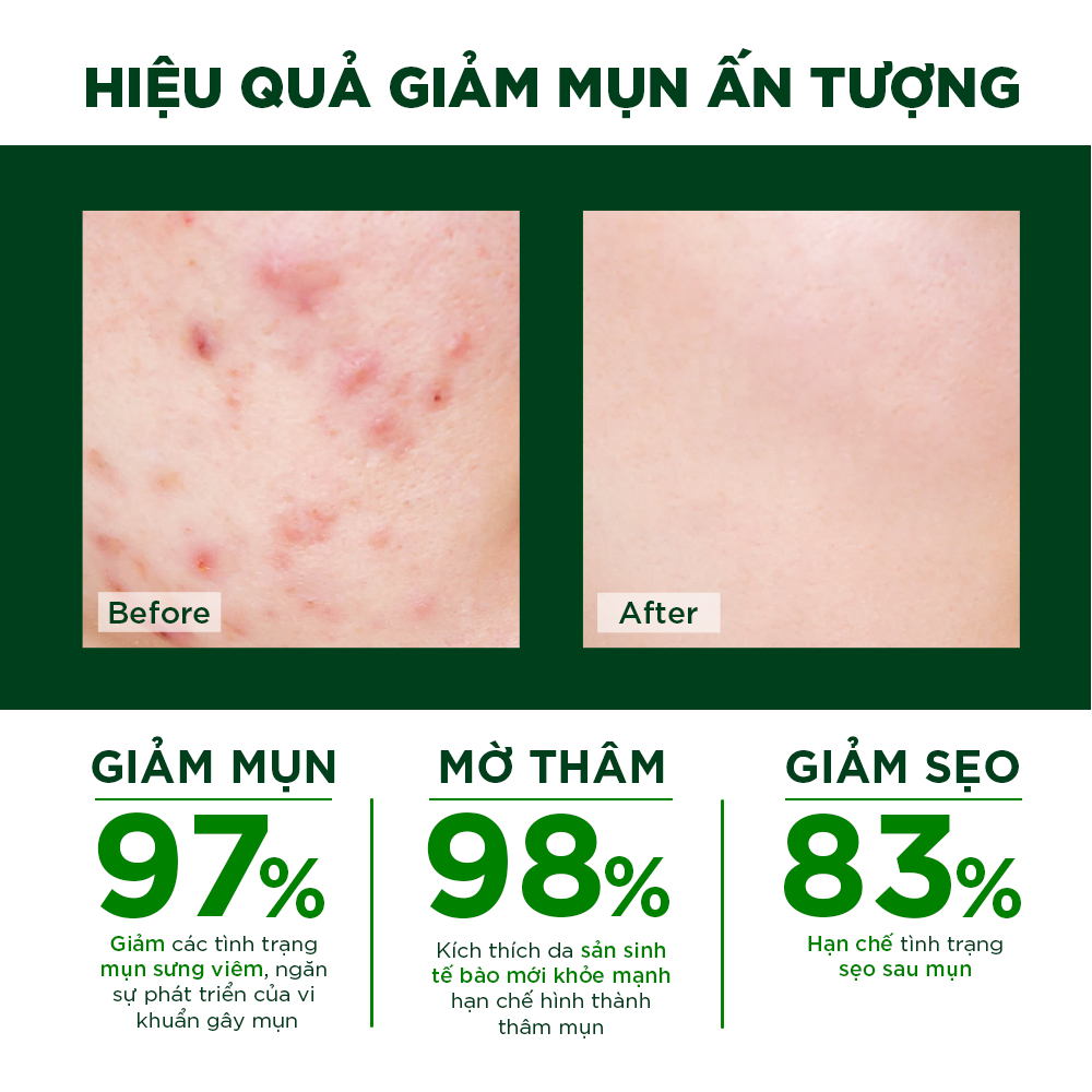 Combo Tẩy Tế Bào Chết Ngừa Mụn Oribe Dưỡng Trắng Da Làm Sạch Và Thu Nhỏ Lỗ Chân Lông Làm Mờ Thâm Mờ Sẹo - 2 tuýp