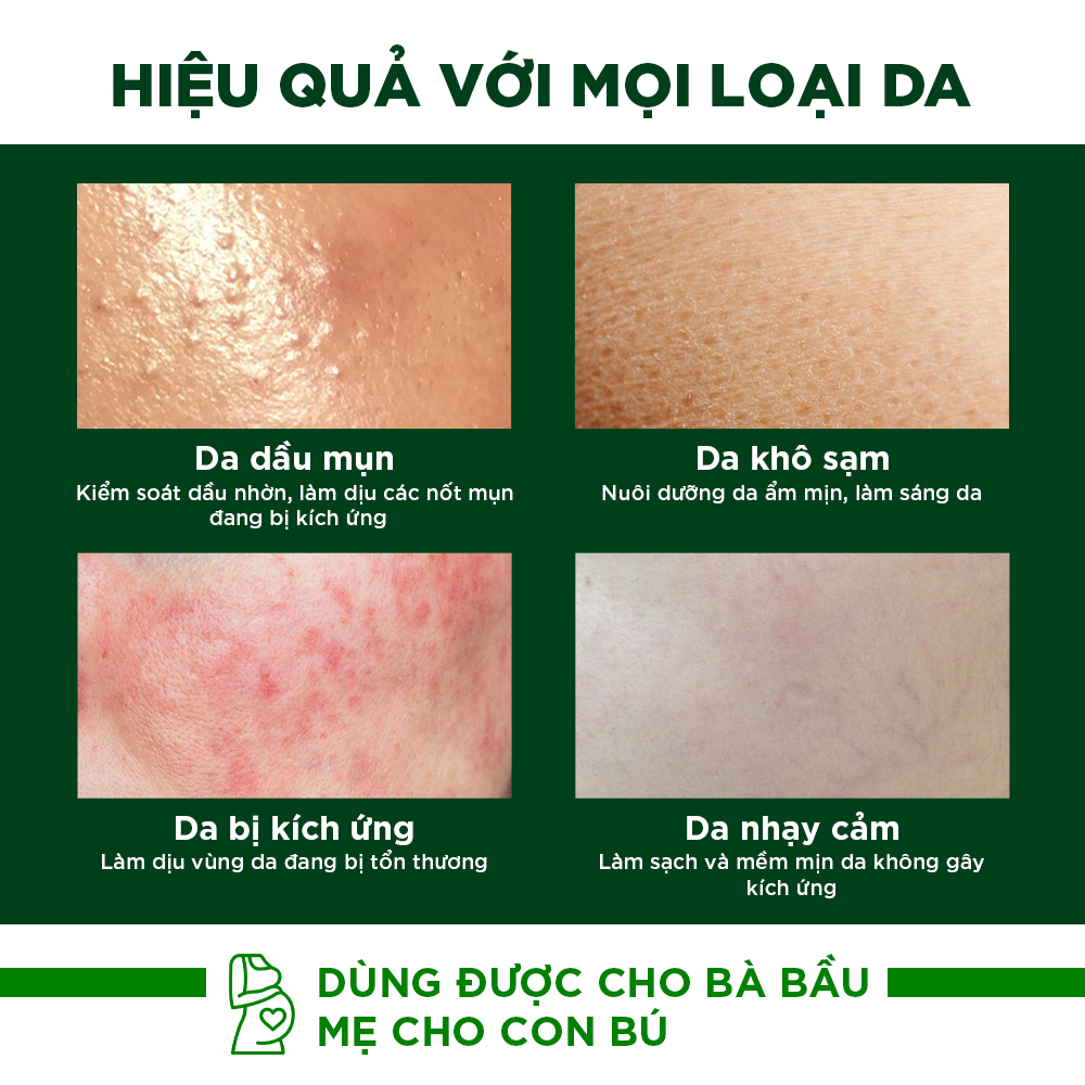 Combo Kem Chống Nắng Nâng Tone Oribe Dưỡng Trắng Và Toner Nước Hoa Hồng Cho Da Mụn Thu Nhỏ Lỗ Chân Lông