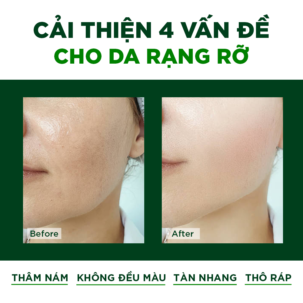 Combo Serum Tinh Chất Phục Hồi  Và Kem Dưỡng Ẩm Ban Đêm Oribe Dưỡng Trắng Thu Nhỏ Lỗ Chân Lông Ngăn Ngừa Lão Hóa - 30g