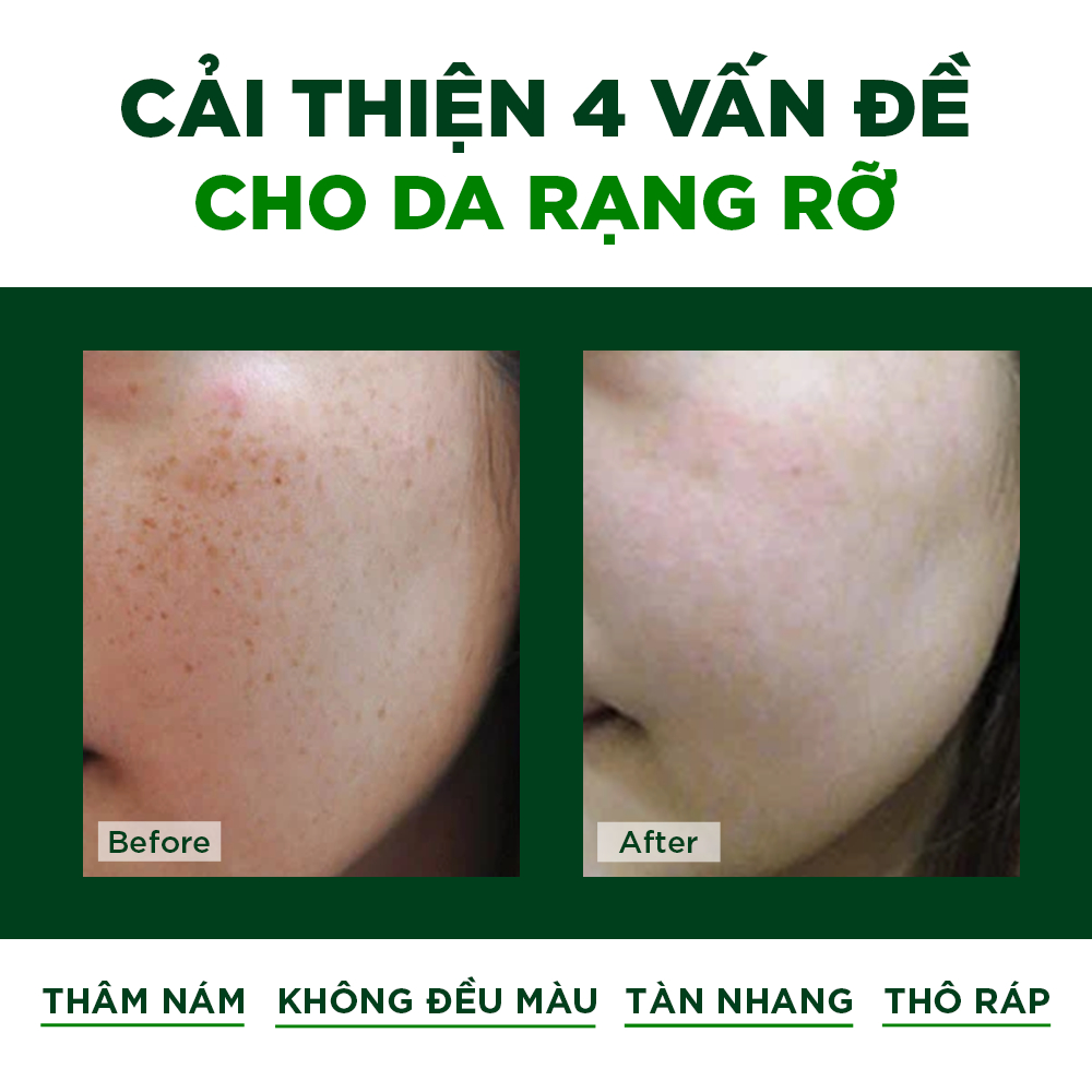 Combo Dưỡng Da, Mờ Nám, Dưỡng Trắng Da, Mờ Nám, Chống Lão Hóa Oribe