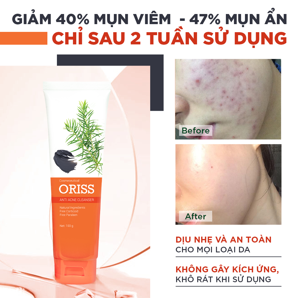 Sữa Rửa Mặt Oriss Dưỡng Trắng Tạo Bọt Ngừa Mụn Dưỡng Ẩm Tẩy Tế Bào Chết Thu Nhỏ Lỗ Chân Lông - 100g