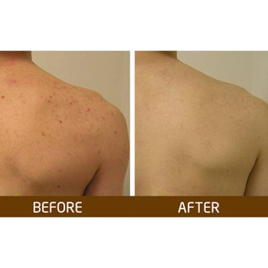 Xà phòng nghệ Thái Lan - Xà bông cam nghệ giúp trắng da, tẩy mụn lưng,không khô da