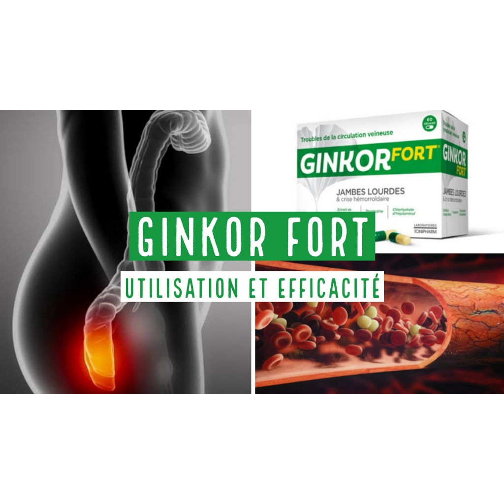 Suy giãn tĩnh mạch Ginkor Forrt Jambes Loudes