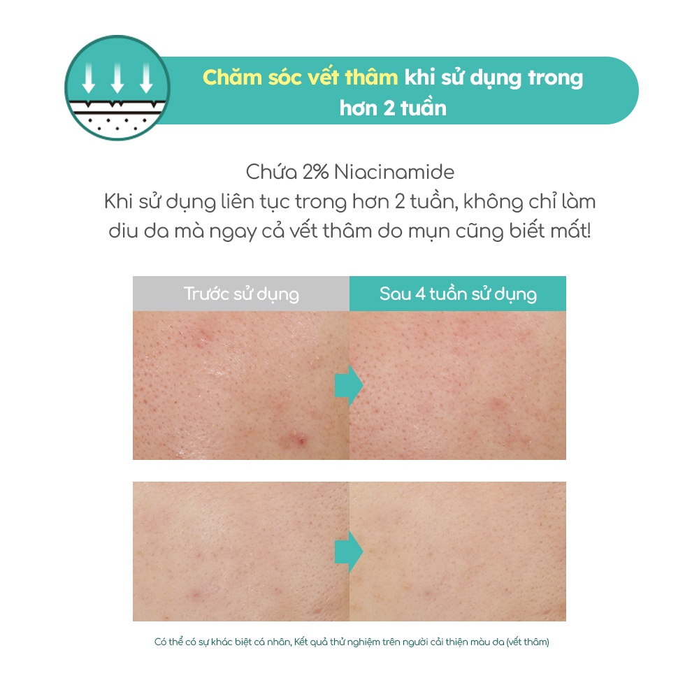 Serum AESTURA A-CICA365 chiết xuất rau má phục hồi, mờ thâm, dịu da