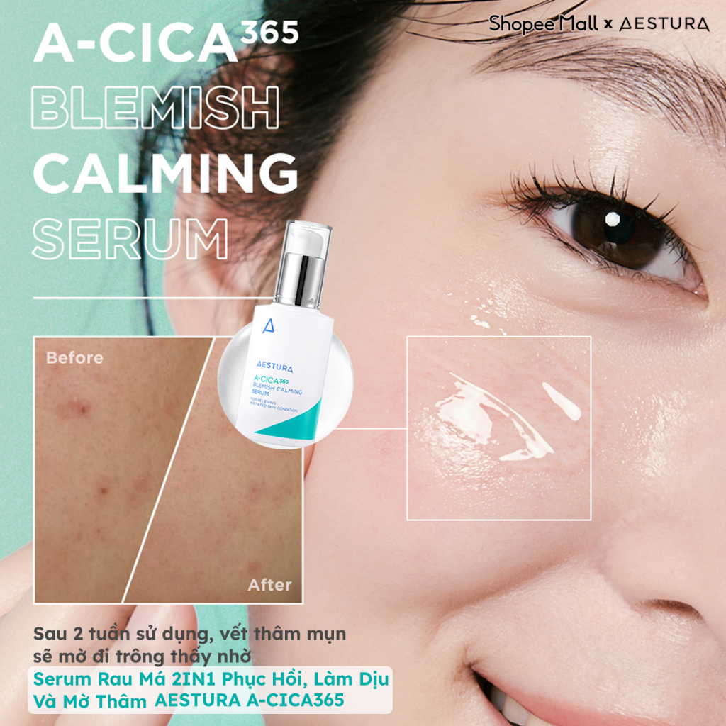 Serum AESTURA A-CICA365 chiết xuất rau má phục hồi, mờ thâm, dịu da