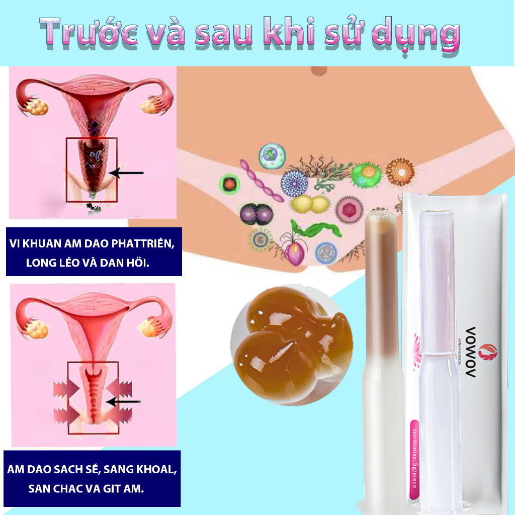 Sản xuất tại Hàn Quốc gel dưỡng ẩm đặt se khít vùng kín làm hồng vùng kín hoàn tiền không hợp lệ COD