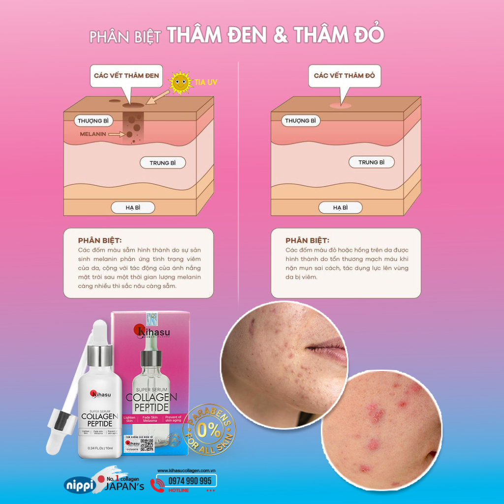 Đại lý - 10 lọ serum collagen KIHASU 50ml làm mờ nám da, vết sạm, đốm nâu, da trắng sáng với Vitamin C (Đại lý)