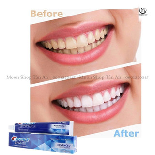 KEM ĐÁNH RĂNG CREST 3D WHITE TRIPLE WHITENING