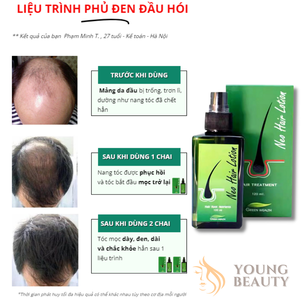 Tinh chất kích mọc tóc NEO HAIR LOTION - Xịt NEO HAIR - Kích thích mọc tóc nhanh, chống gãy rụng 120ml - YOUNG BEAUT