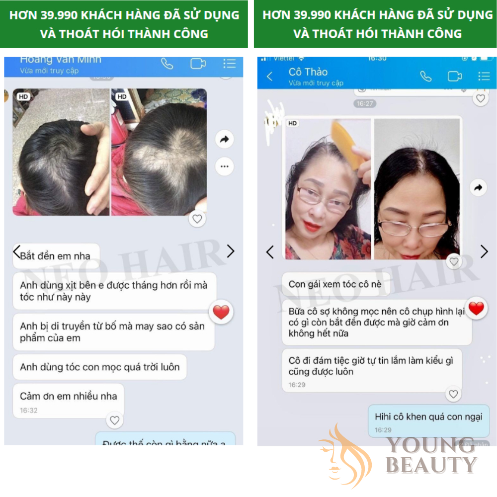 Tinh chất kích mọc tóc NEO HAIR LOTION - Xịt NEO HAIR - Kích thích mọc tóc nhanh, chống gãy rụng 120ml - YOUNG BEAUT