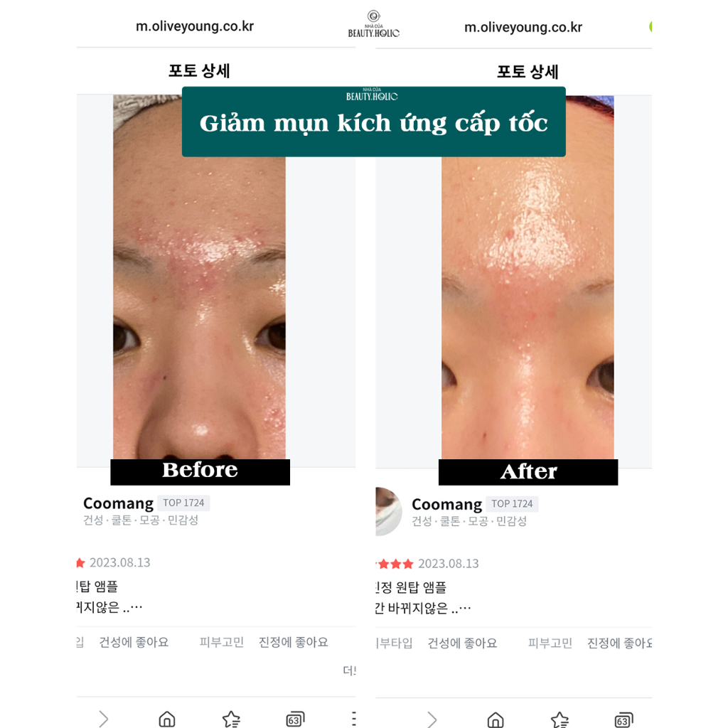 Serum rau má phục hồi BEPLAIN CICATEROL AMPOULE