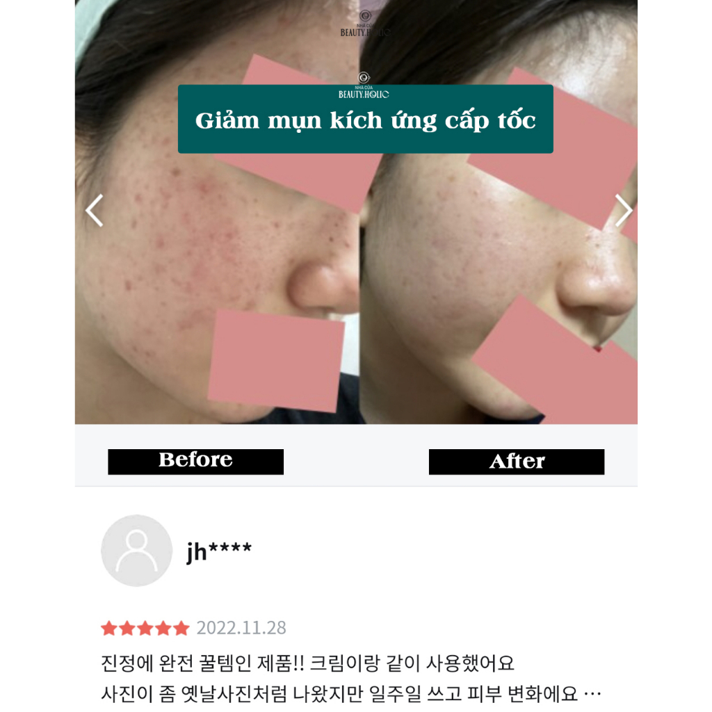 Serum rau má phục hồi BEPLAIN CICATEROL AMPOULE
