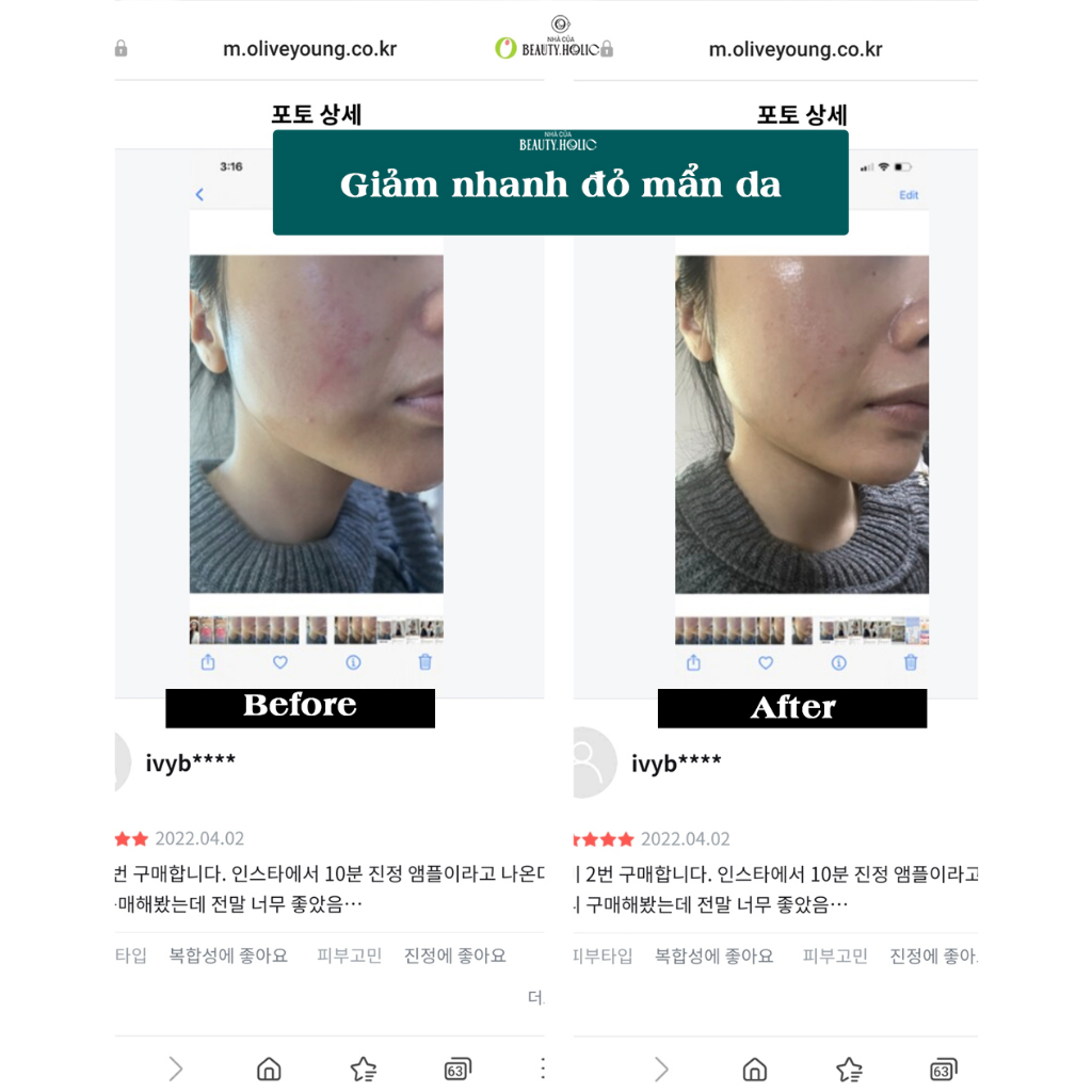 Serum rau má phục hồi BEPLAIN CICATEROL AMPOULE