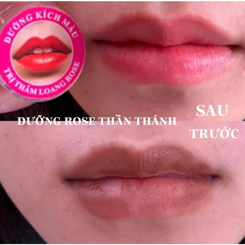 Son dưỡng môi, giảm thâm, kích màu thâm loang ROSE