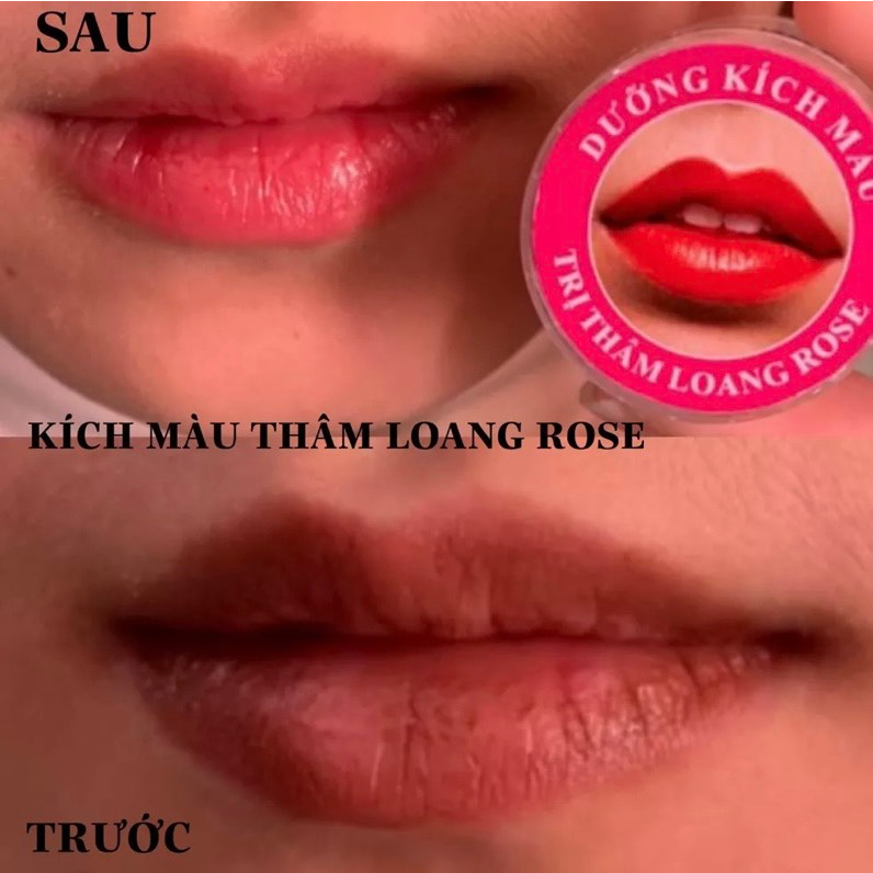 Son dưỡng môi, giảm thâm, kích màu thâm loang ROSE
