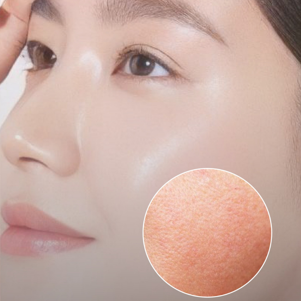 Thay Da Sinh Học Red Peel Tingle Serum 11ml Phiên Bản Mới