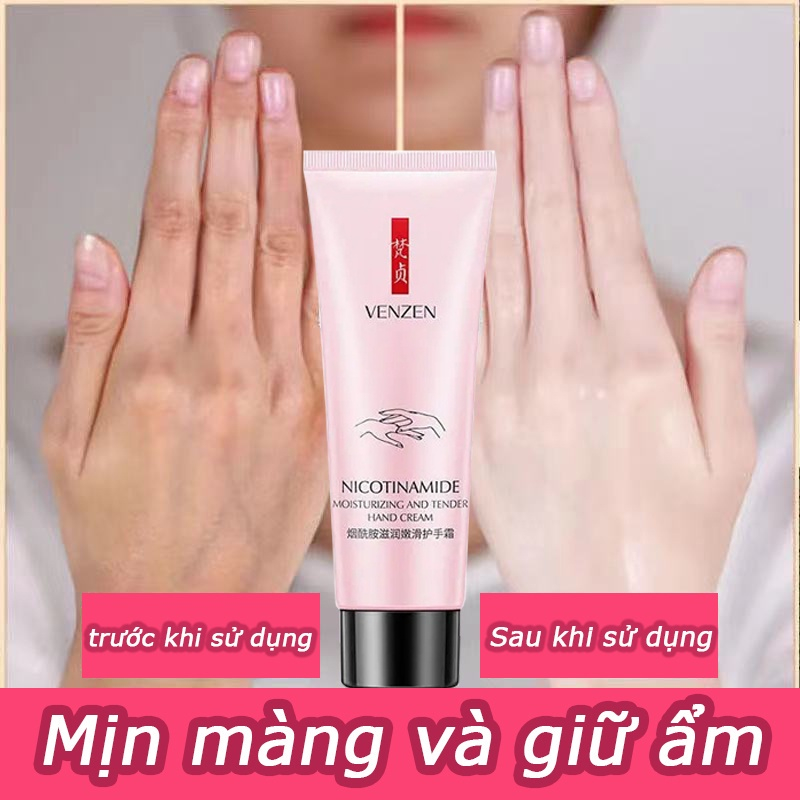 Kem dưỡng da tay Làm trắng xóa nếp nhăn nuôi dưỡng da dưỡng ẩm không nhờn dính dễ tán Hấp thụ nhanh xóa nếp nhăn.