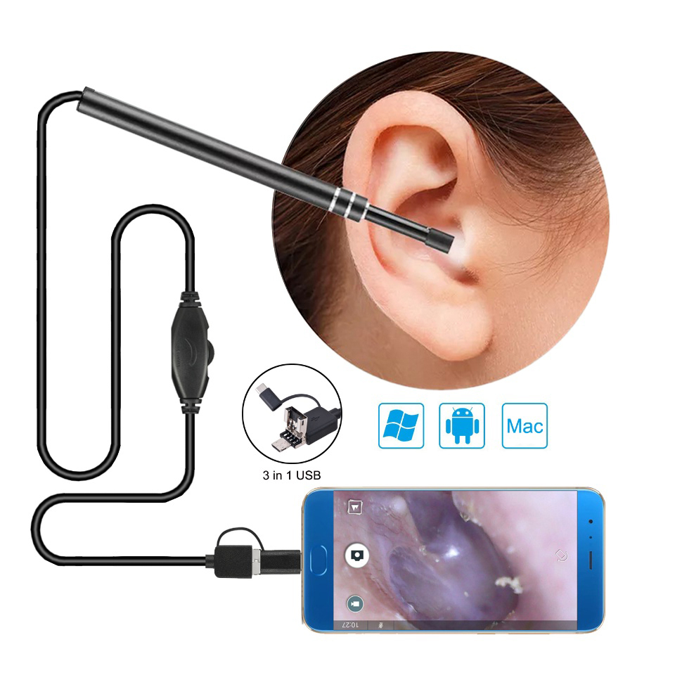 Camera Nội Soi Tai KAW Siêu Nét Đi Kèm Bộ Đầu Lấy Ráy Thông Minh - Hàng Chính Hãng