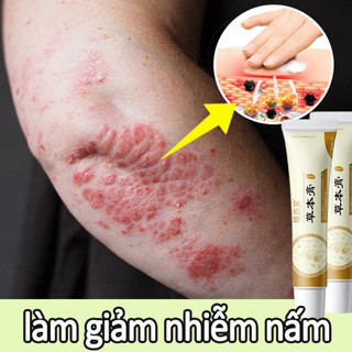 Kem bôi ngứa kem bôi hắc lào kem thảo dược tự nhiên kem kháng khuẩn 20g làm giảm nhiễm nấm và rêu da giảm ngứa.