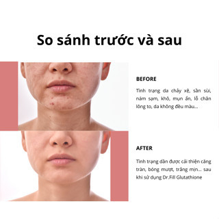 Miếng Ngậm Trắng Da DR ESTHER Formula Glutathione Direct Film 3X Hàn Quốc Tinh Chất Dưỡng