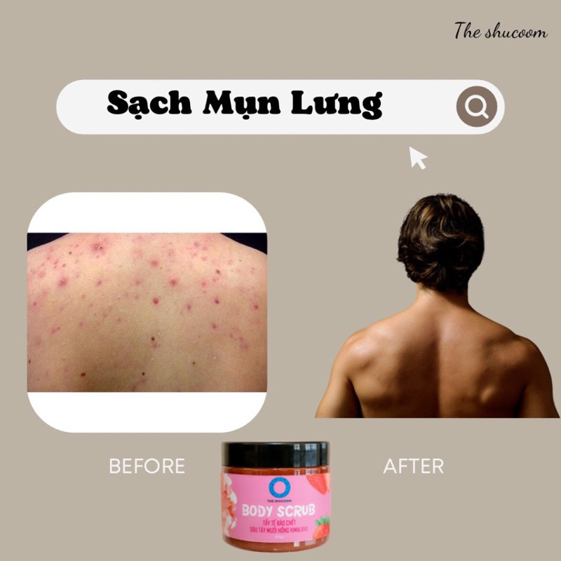 Tẩy tbc 150 pass 80