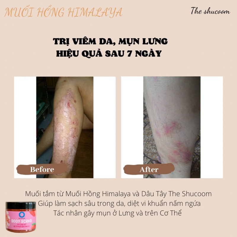 Tẩy tbc 150 pass 80