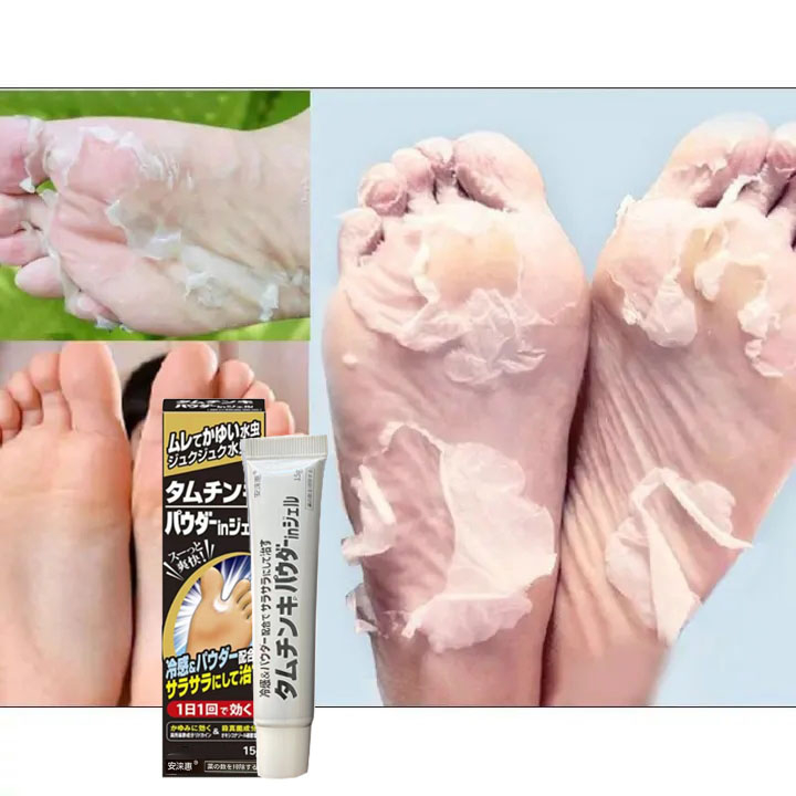 Nhật Bản Kem Khử mùi hôi chân mồ hôi chân và thối chân dạng Chàm Chống Ngứa Hiệu Quả Kem Dưỡng Da Chân Chống Nấm Và Ngứ