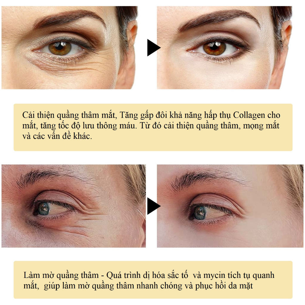 Mặt Nạ Collagen EELHOE Vàng 24K Gel Dưỡng Ẩm Tự Nhiên, Loại Bỏ Quầng Thâm Mắt, Chống Lão Hóa hiệu quả - Loki Care