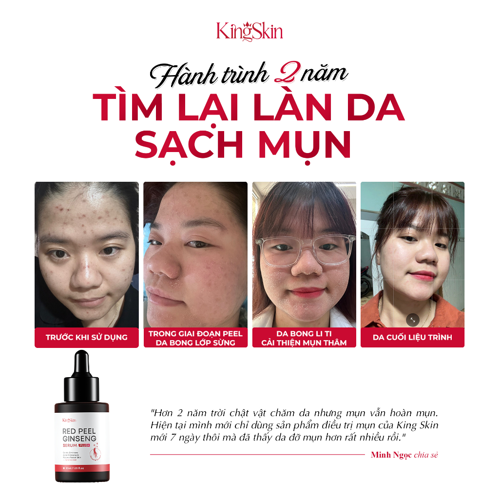 Serum tái tạo da KING SKIN red peel ginseng plus+ 30ml