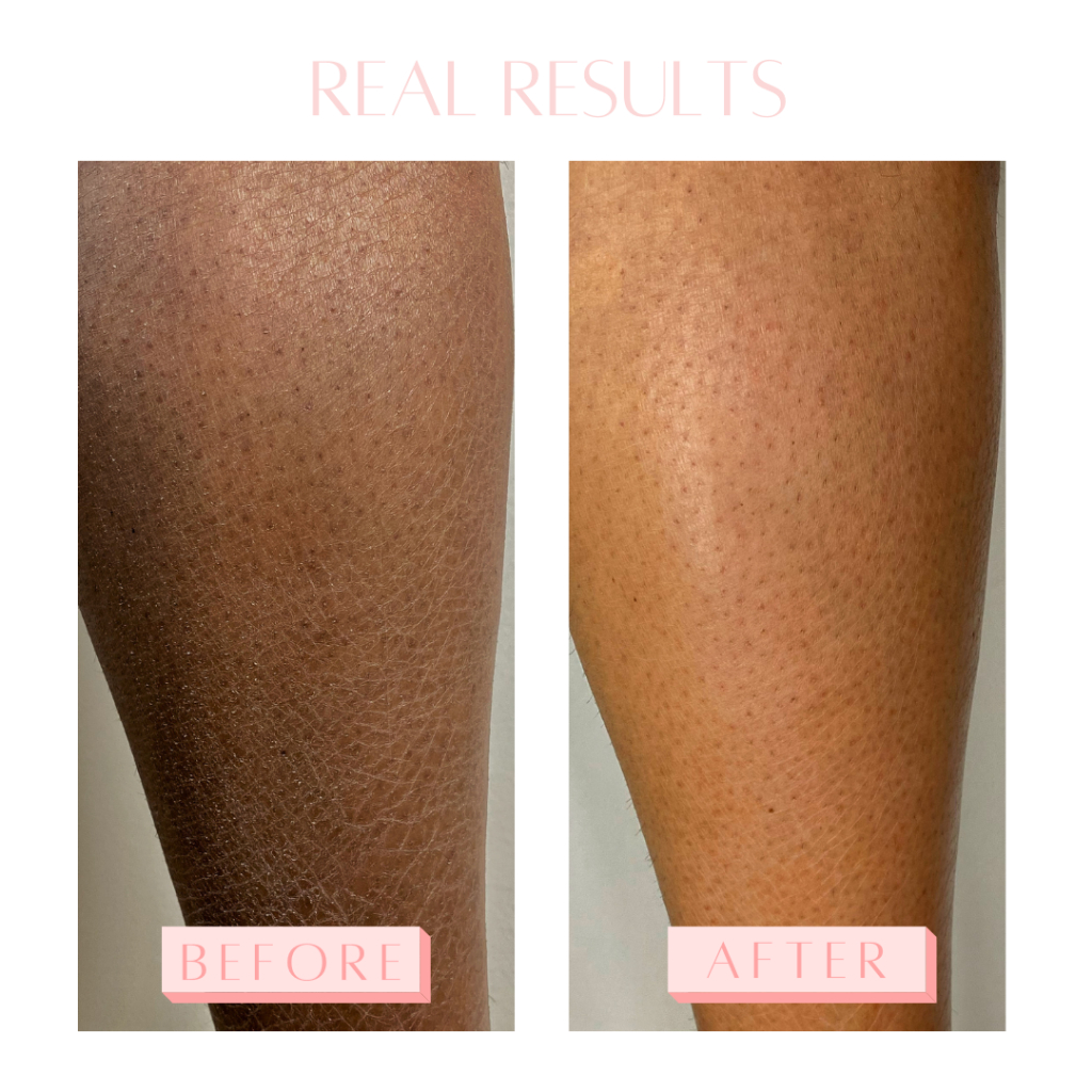 Hàng Thổ Nhỹ Kỳ Găng tay tẩy tế bào chết cao cấp SkinGlow.us găng tay kì ghét