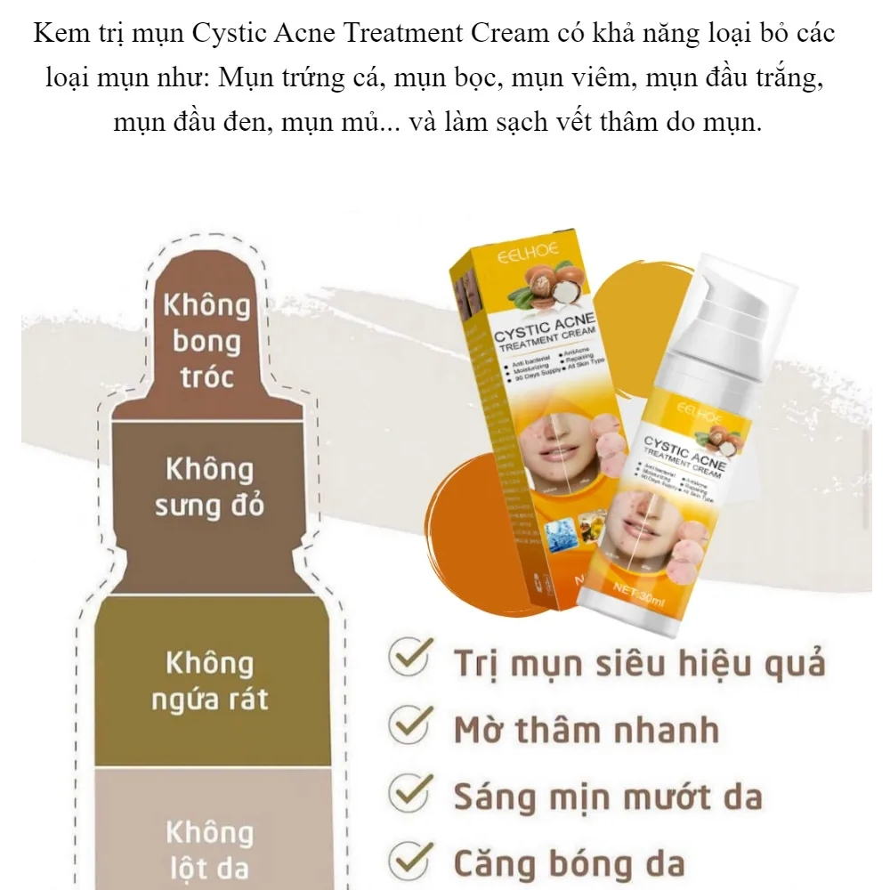 Kem Giảm Mụn Cấp Tốc Loại Bỏ Mụn và Vết Thâm Hoàn Toàn Thu Nhỏ Lỗ Chân Lông CYSTIC A